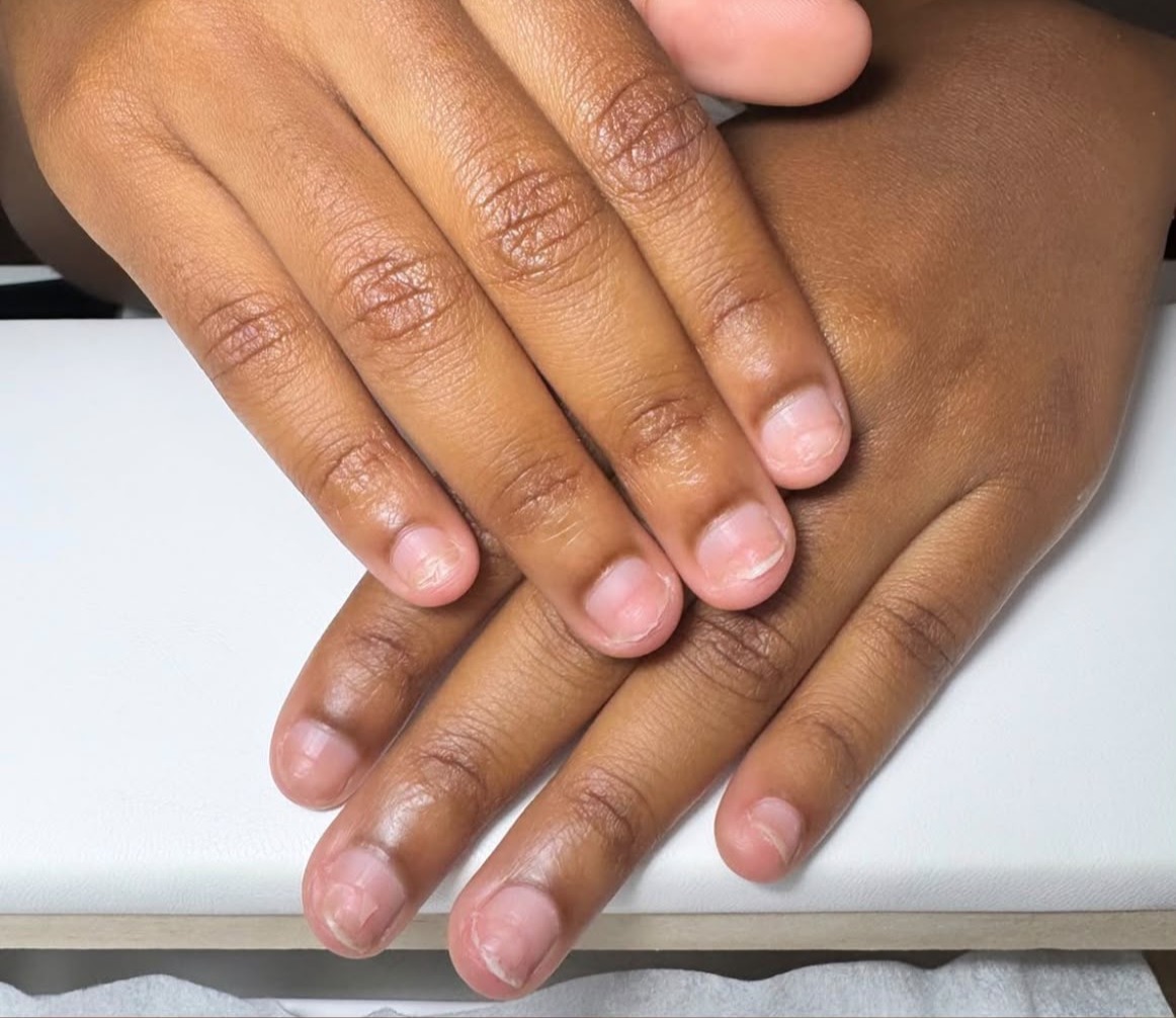 Antes das unhas com acabamento natural